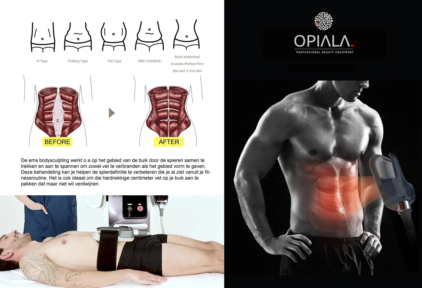 Opiala EMS Body Sculpting + RF